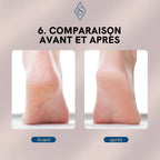 Electric callus remover for feet