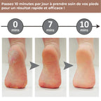 Electric callus remover for feet