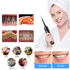 ELECTRIC DENTAL CALCULUS REMOVER + FREE ACCESSORY KIT