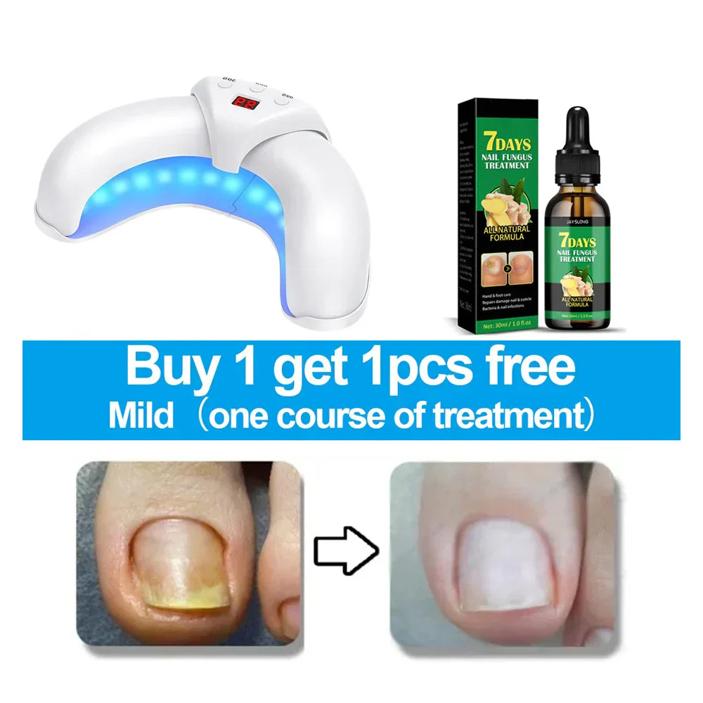 Rapid Laser Nail Treatment Device - FREE Repair Oil