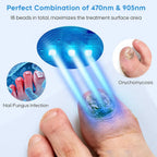Rapid Laser Nail Treatment Device - FREE Repair Oil