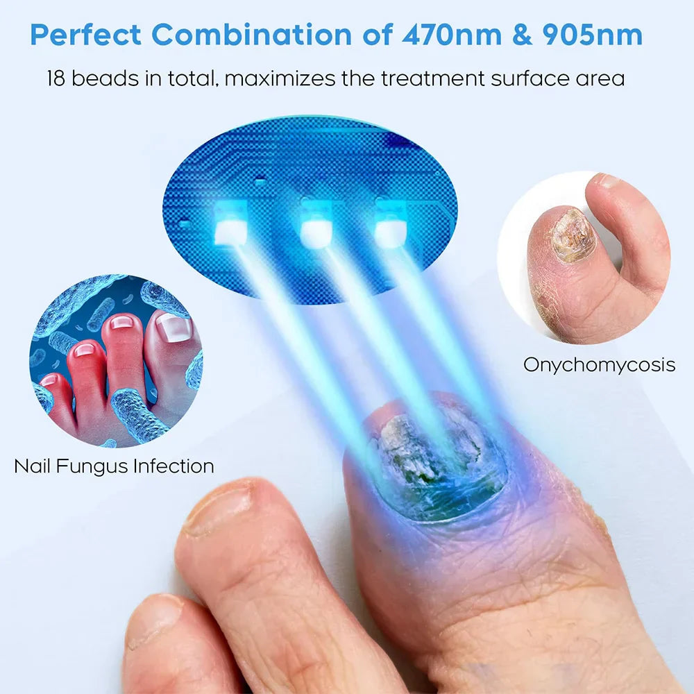 Rapid Laser Nail Treatment Device - FREE Repair Oil