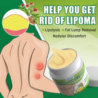 Soothing Cream for Lipomas and Nodules