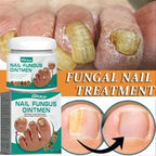 Solution Antifongique - Mycose Ongles - 1 ACHETÉ = 1 OFFERT