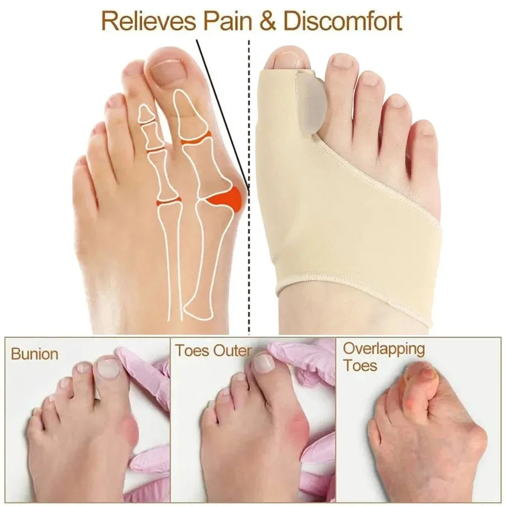 Orthopedic Bunion Corrector 1 Pair — Toe Separator