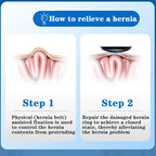 Inguinal Hernia Belt