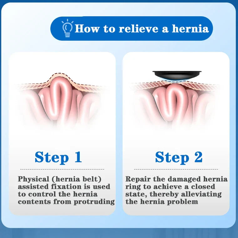 Inguinal Hernia Belt