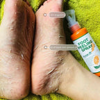 Spray Exfoliant pour Pieds à l'huile d'Orange