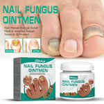 Solution Antifongique - Mycose Ongles - 1 ACHETÉ = 1 OFFERT