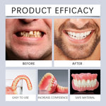 Kit de Prothèse Dentaire - Correction Instantanée du Sourire