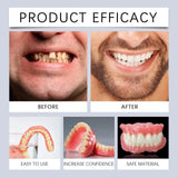 Kit de Prothèse Dentaire - Correction Instantanée du Sourire