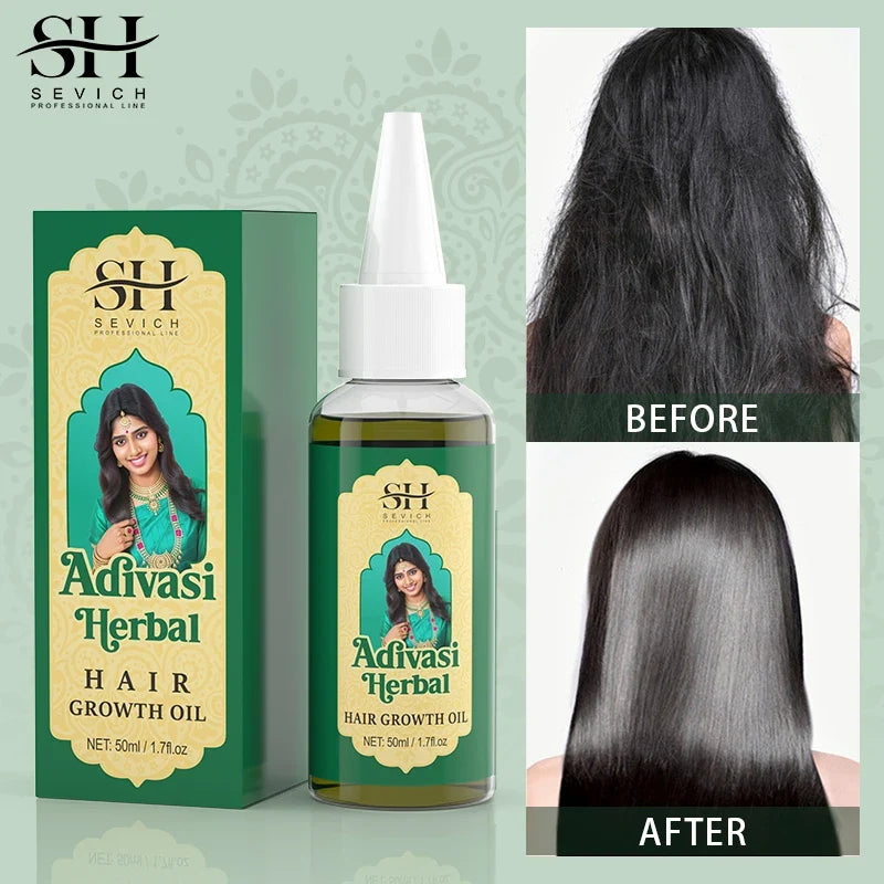 Huile Indienne de Pousse Cheveux