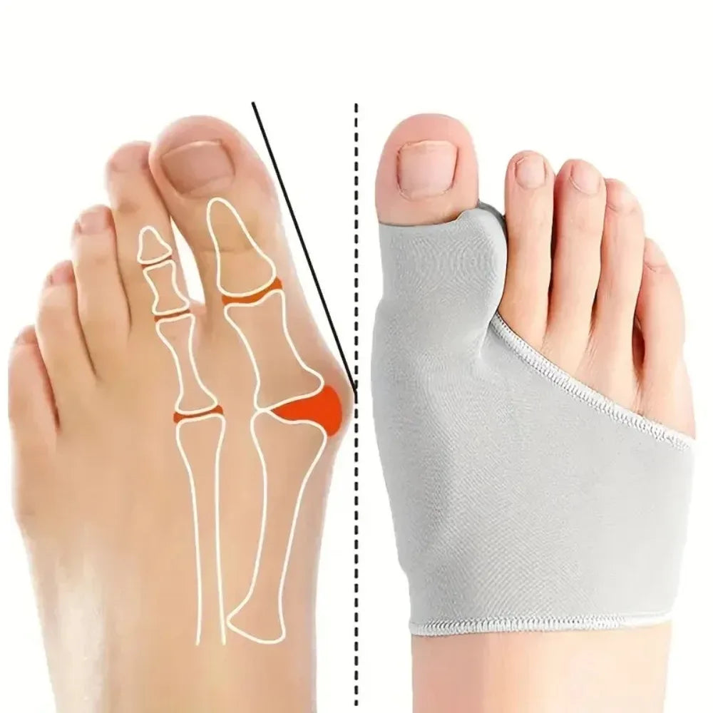 Orthopedic Bunion Corrector 1 Pair — Toe Separator