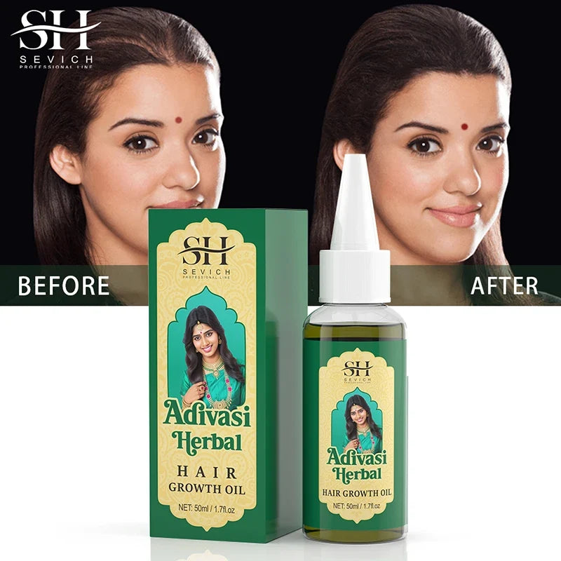 Huile Indienne de Pousse Cheveux