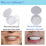 Facettes dentaires artificielles