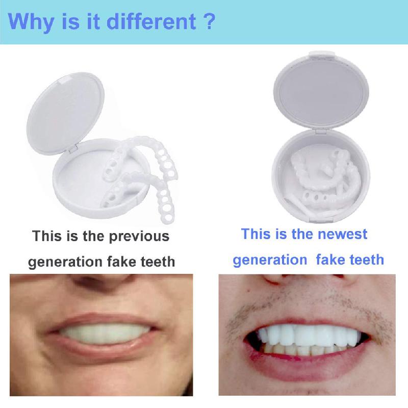 Facettes dentaires artificielles