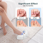 Fungus Treatment Express – Stop Nail Mycosis + FREE OILS