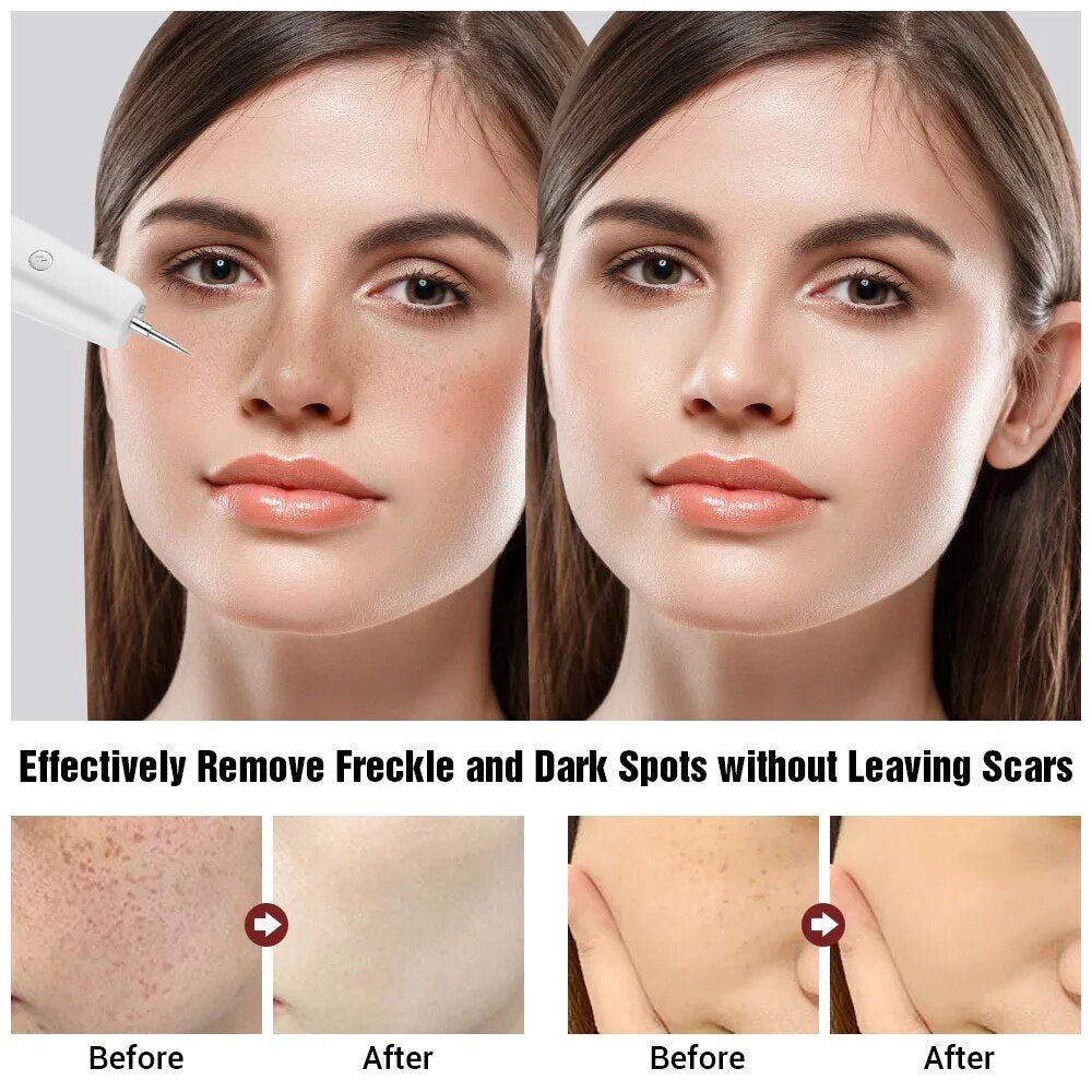 Perfect Skin - Anti-Blemish Pen