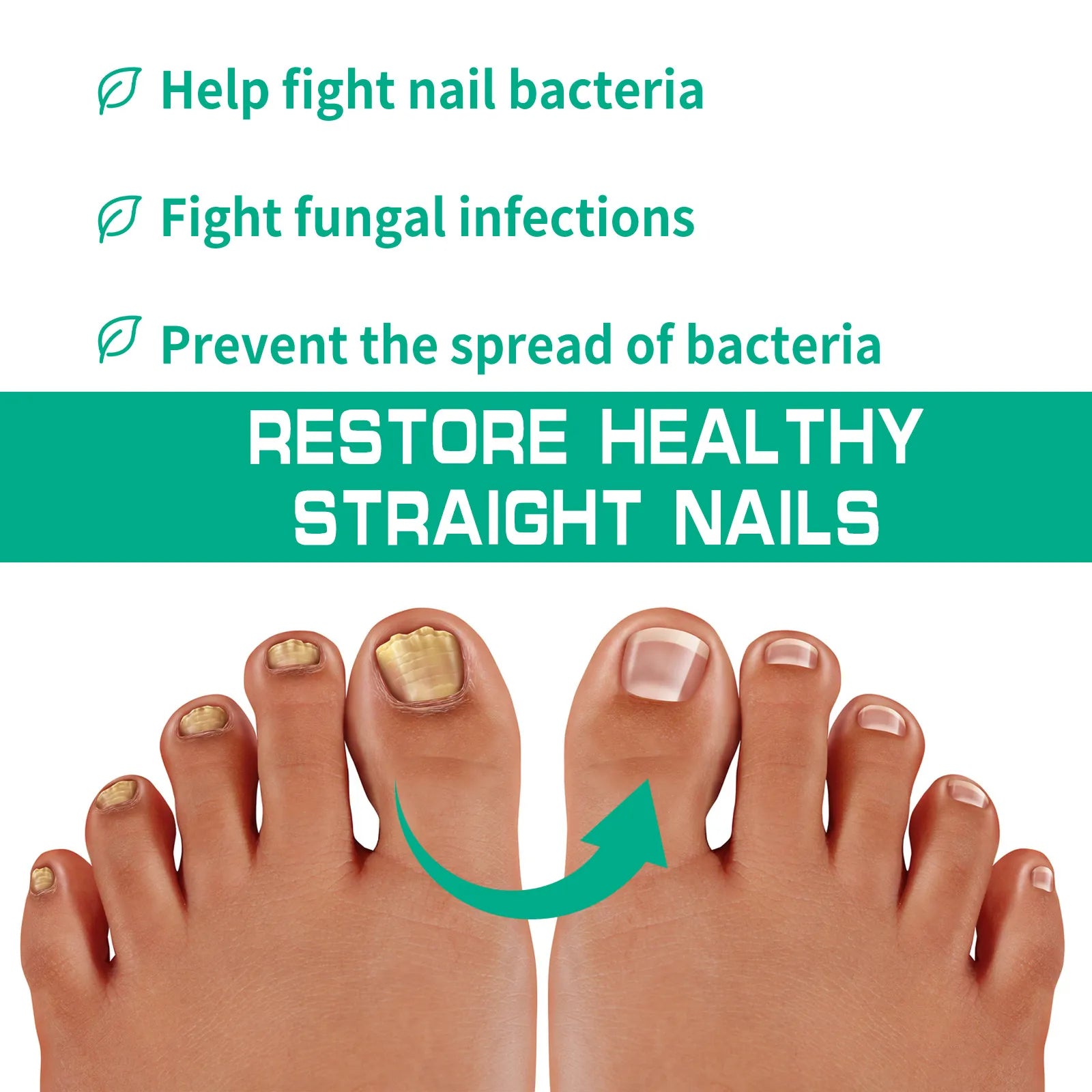 Solution Antifongique - Mycose Ongles - 1 ACHETÉ = 1 OFFERT