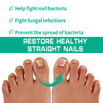 Solution Antifongique - Mycose Ongles - 1 ACHETÉ = 1 OFFERT