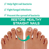 Solution Antifongique - Mycose Ongles - 1 ACHETÉ = 1 OFFERT