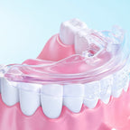 3-Pack Dental Alignment Trays