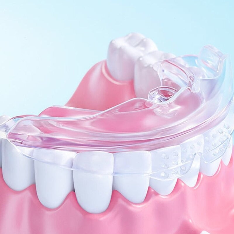 3-Pack Dental Alignment Trays