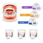 3-Pack Dental Alignment Trays