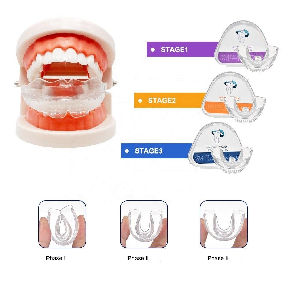3-Pack Dental Alignment Trays