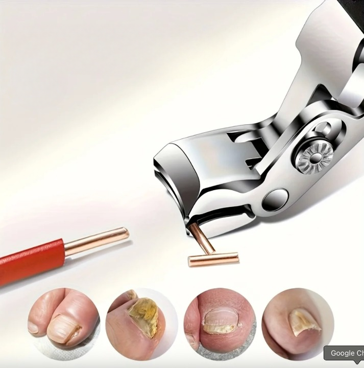 Ingrown Toenail Clipper Set - 4PCS