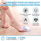 Appareil de traitement au laser pour champignon des ongles