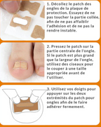 Patchs Correcteurs d'Ongles Incarnés