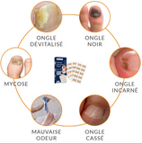 Patchs Correcteurs d'Ongles Incarnés