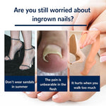 Patchs Correcteurs d'Ongles Incarnés
