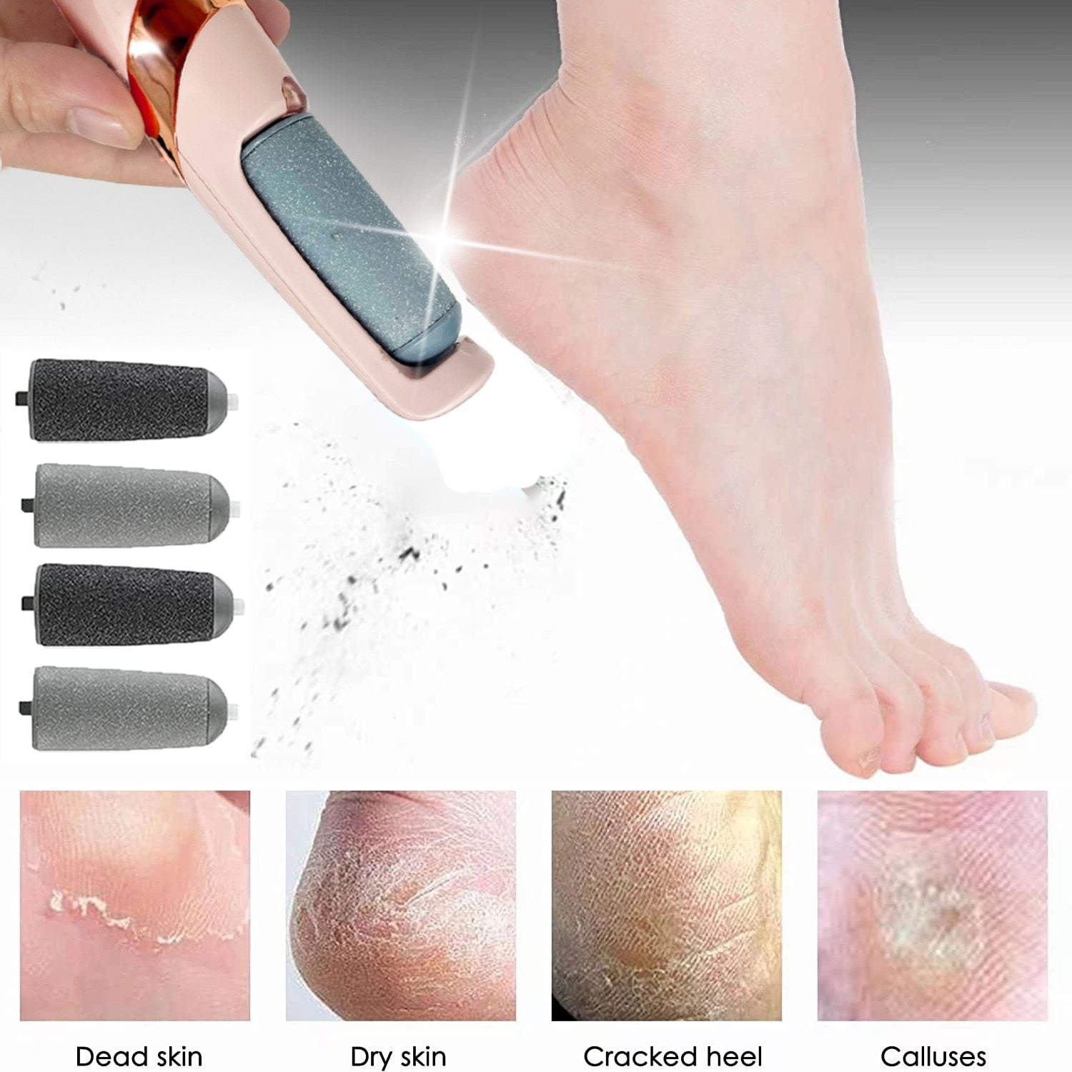 Electric callus remover for feet