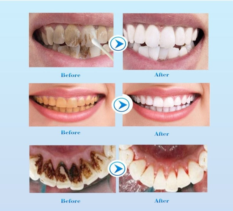 Magic Smile - Dentifrice EXTRA Blanchissant