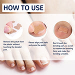 Patchs Correcteurs d'Ongles Incarnés