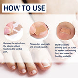 Patchs Correcteurs d'Ongles Incarnés