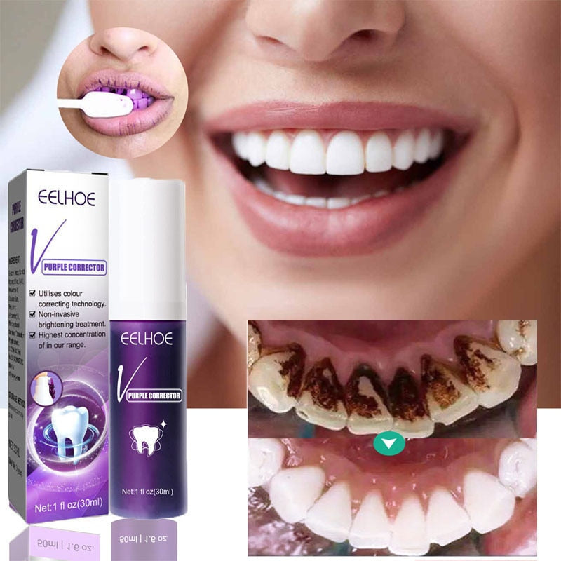 Magic Smile - Dentifrice EXTRA Blanchissant