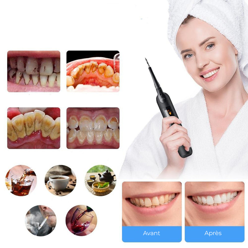 Détartreur-dentaire-électrique-Nouvelle-génération