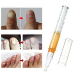 Stylo magique réparateur d'ongles